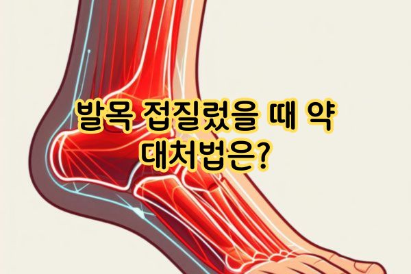 발목 접질렀을 때 약, 대처법은?