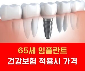 65세 임플란트 건강보험 적용시 가격 65세 임플란트 건강보험 적용시 가격