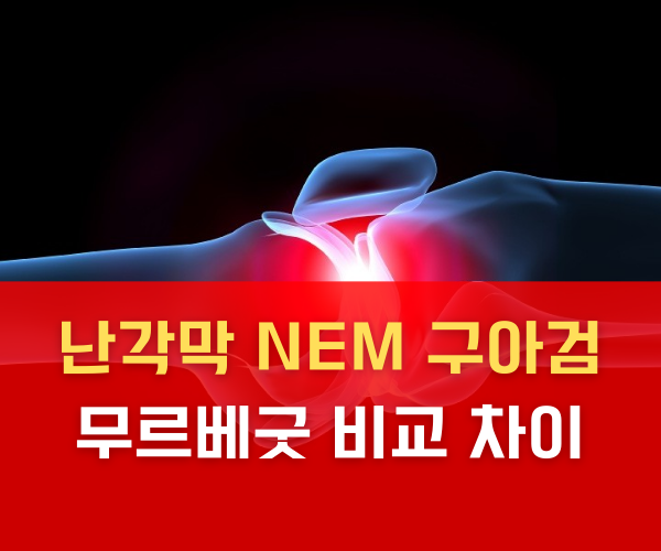 난각막 NEM 구아검 무르베굿 비교 차이
