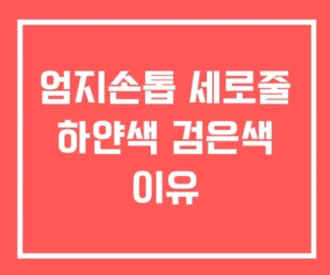 엄지손톱 세로줄 하얀색 검은색 이유